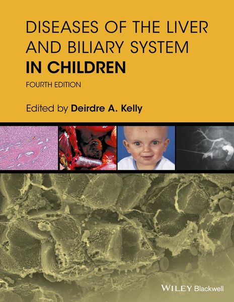 Produktbild: Diseases of the Liver and Biliary System in Children
