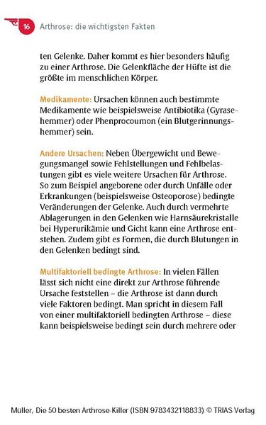 Produktbild: Die 50 besten Arthrose-Killer