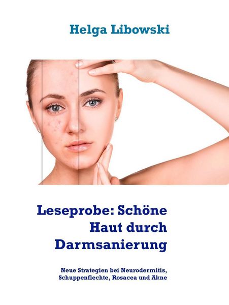 Produktbild: Leseprobe: Sch&ouml;ne Haut durch Darmsanierung