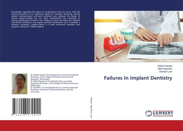 Produktbild: Failures In Implant Dentistry