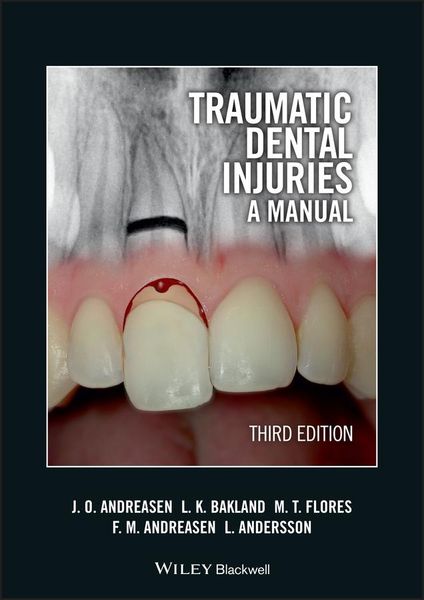 Produktbild: Traumatic Dental Injuries
