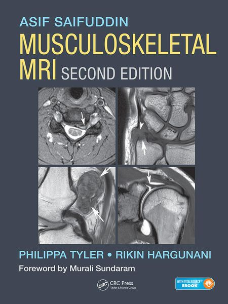Produktbild: Musculoskeletal MRI