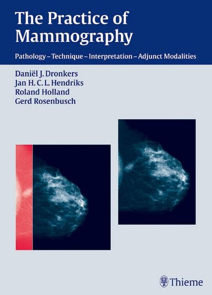 Produktbild: The Practice of Mammography
