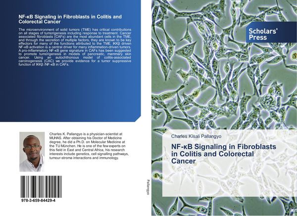 Produktbild: NF-&iquest;B Signaling in Fibroblasts in Colitis and Colorectal Cancer