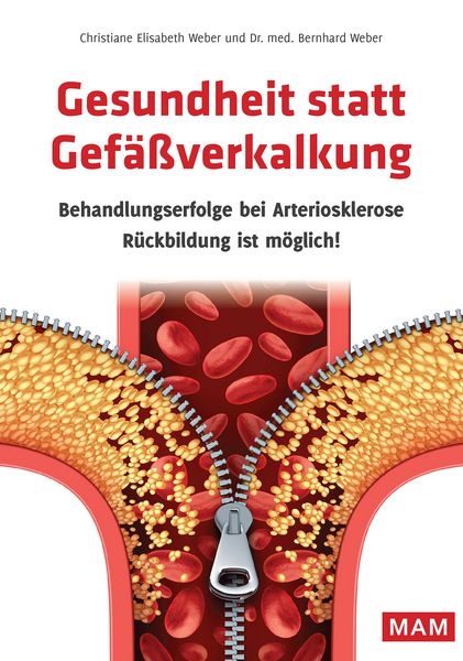 Produktbild: Gesundheit statt Gef&auml;&szlig;verkalkung