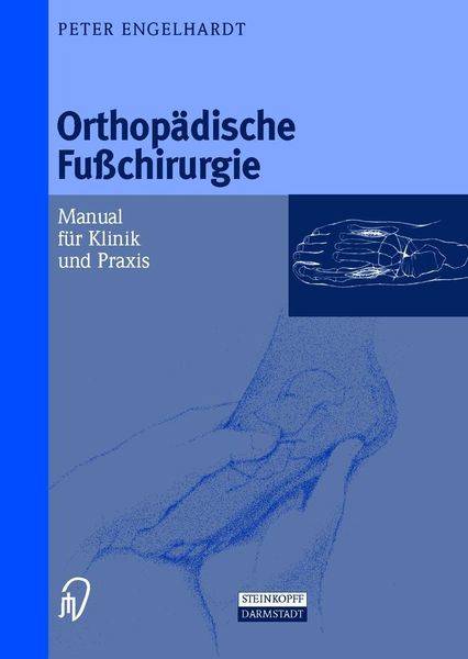 Produktbild: Engelhardt, P: Orthop&auml;dische Fu&szlig;chirurgie