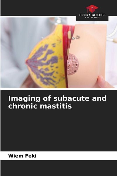 Produktbild: Imaging of subacute and chronic mastitis