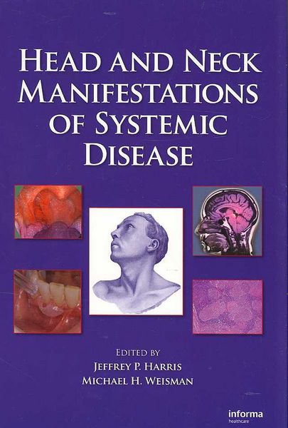 Produktbild: Head and Neck Manifestations of Systemic Disease