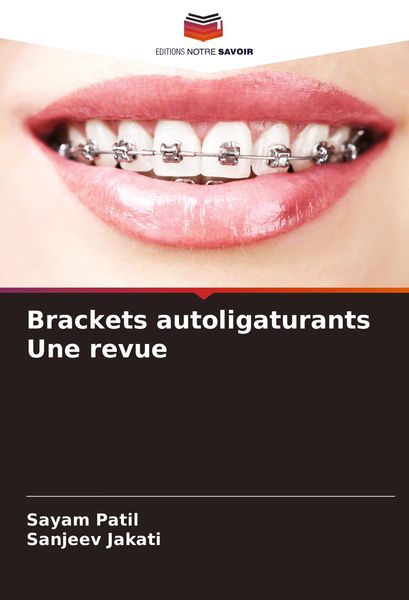 Produktbild: Brackets autoligaturants Une revue