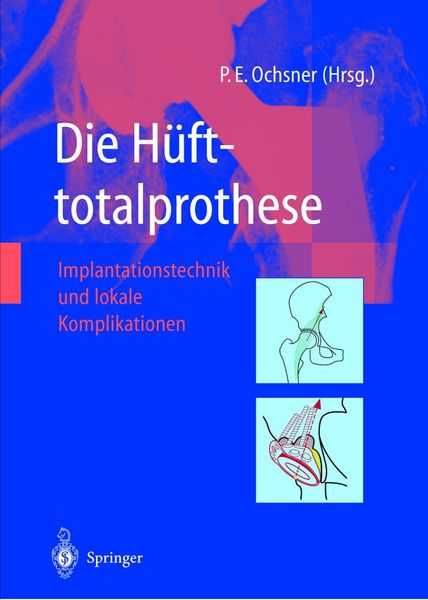 Produktbild: Die H&uuml;fttotalprothese
