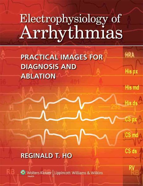 Produktbild: Ho, R: Electrophysiology of Arrhythmias