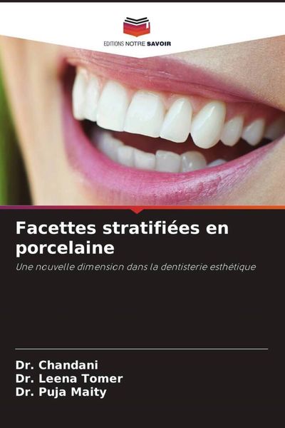 Produktbild: Facettes stratifi&eacute;es en porcelaine