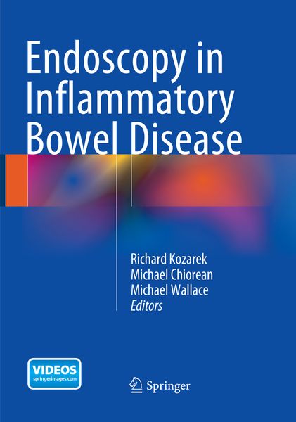 Produktbild: Endoscopy in Inflammatory Bowel Disease