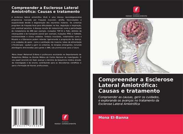 Produktbild: Compreender a Esclerose Lateral Amiotr&oacute;fica: Causas e tratamento