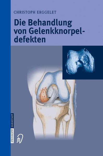 Produktbild: Die Behandlung von Gelenkknorpeldefekten