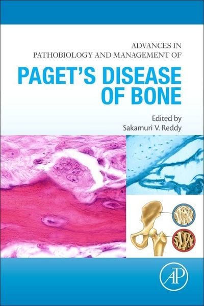 Produktbild: Advances in Pathobiology and Management of Paget's Disease of Bone
