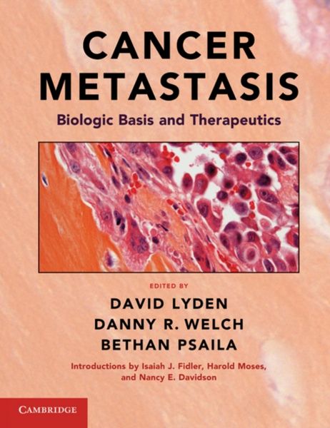 Produktbild: Cancer Metastasis