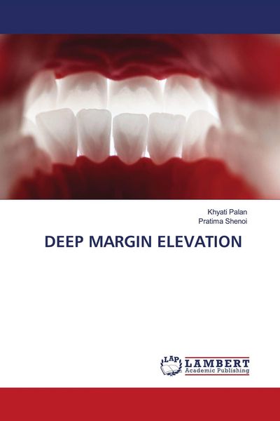 Produktbild: DEEP MARGIN ELEVATION