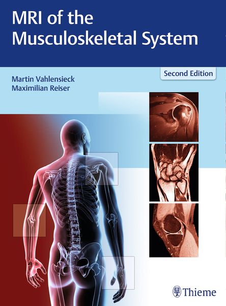 Produktbild: MRI of the Musculoskeletal System
