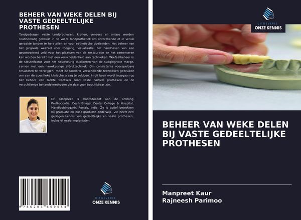 Produktbild: Beheer Van Weke Delen Bij Vaste Gedeeltelijke Prothesen