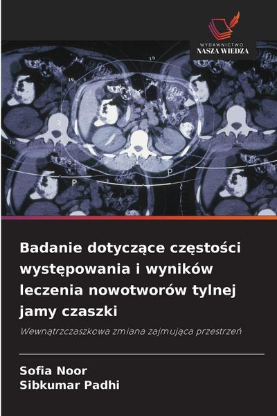 Produktbild: Badanie dotycz&iquest;ce cz&iquest;sto&iquest;ci wyst&iquest;powania i wynik&oacute;w leczenia nowotwor&oacute;w tylnej jamy czaszki
