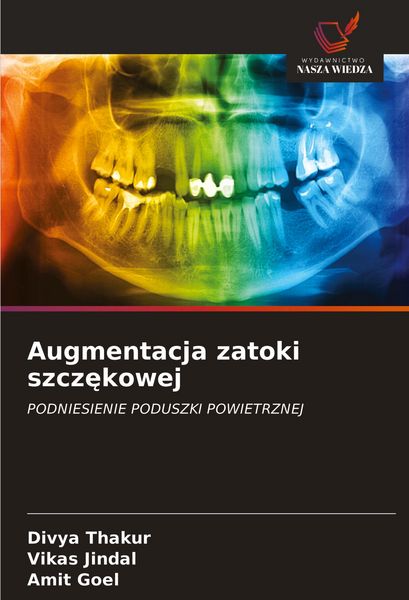 Produktbild: Augmentacja zatoki szcz&iquest;kowej