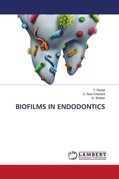 Produktbild: Biofilms in Endodontics