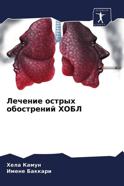 Produktbild: Lechenie ostryh obostrenij HOBL