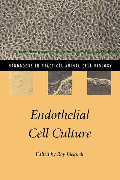 Produktbild: Endothelial Cell Culture