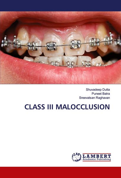 Produktbild: CLASS III MALOCCLUSION