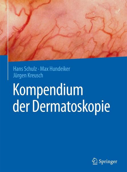 Produktbild: Kompendium der Dermatoskopie