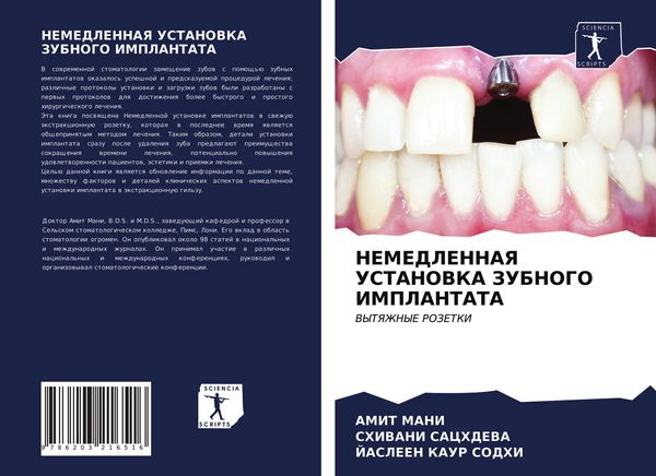 Produktbild: Nemedlennaya Ustanovka Zubnogo Implantata
