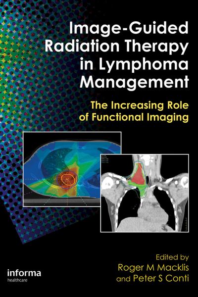 Produktbild: Image-Guided Radiation Therapy in Lymphoma Management