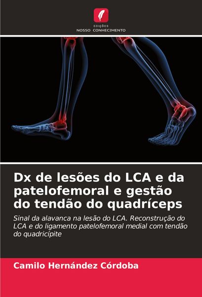 Produktbild: Dx de les&otilde;es do LCA e da patelofemoral e gest&atilde;o do tend&atilde;o do quadr&iacute;ceps