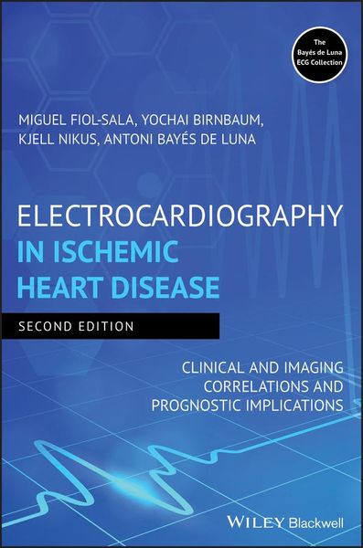 Produktbild: Electrocardiography in Ischemic Heart Disease