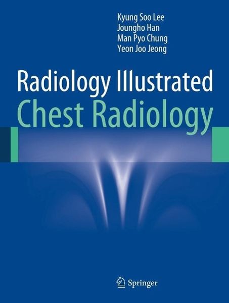 Produktbild: Radiology Illustrated: Chest Radiology