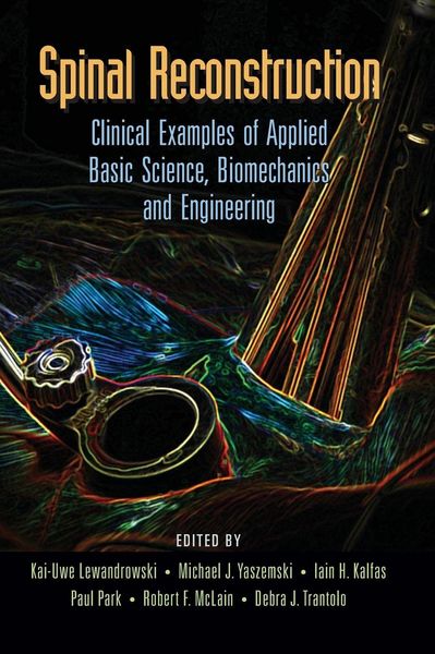 Produktbild: Spinal Reconstruction