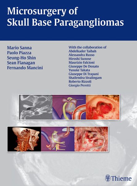 Produktbild: Microsurgery of Skull Base Paragangliomas