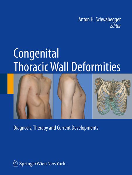 Produktbild: Congenital Thoracic Wall Deformities