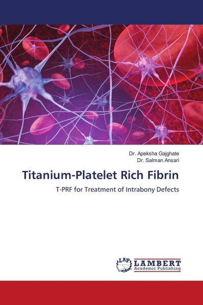 Produktbild: Titanium-Platelet Rich Fibrin