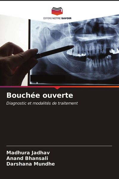 Produktbild: Bouch&eacute;e ouverte
