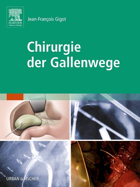 Produktbild: Chirurgie der Gallenwege