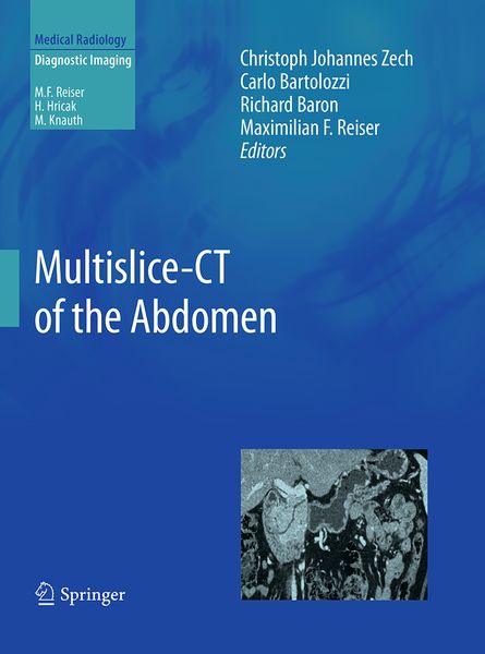 Produktbild: Multislice-CT of the Abdomen