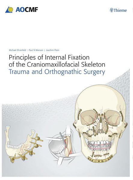 Produktbild: Principles of Internal Fixation of the Craniomaxillofacial Skeleton