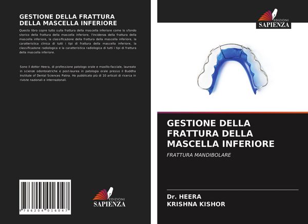 Produktbild: Gestione Della Frattura Della Mascella Inferiore