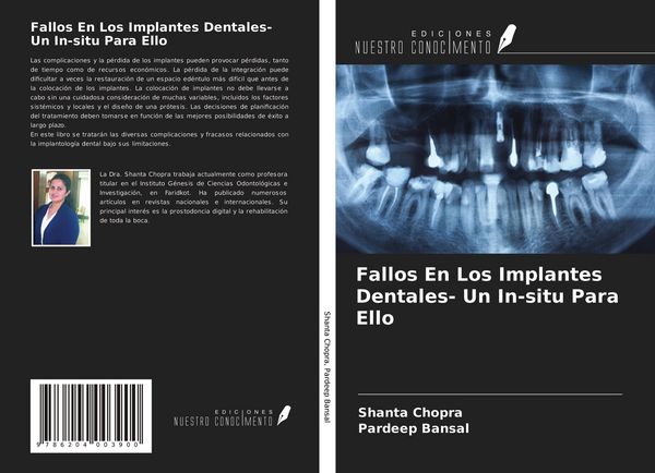 Produktbild: Fallos En Los Implantes Dentales- Un In-situ Para Ello