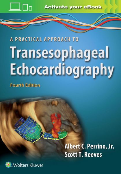 Produktbild: Perrino, A: Practical Approach to Transesophageal Echocardio