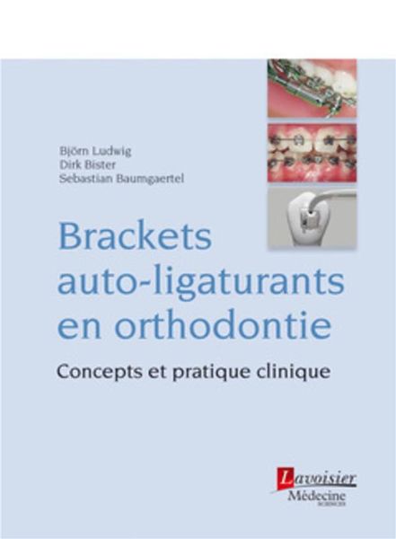 Produktbild: Brackets auto-ligaturants en orthodontie