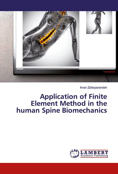Produktbild: Application of Finite Element Method in the human Spine Biomechanics