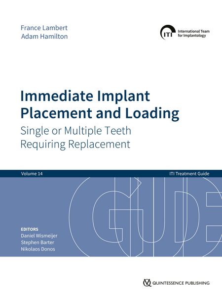 Produktbild: Immediate Implant Placement and Loading - Single or Multiple Teeth Requiring Replacement